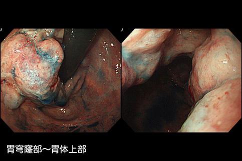 画像ID:11441