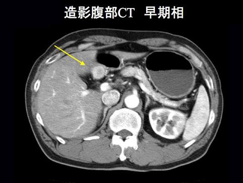 画像ID:11492
