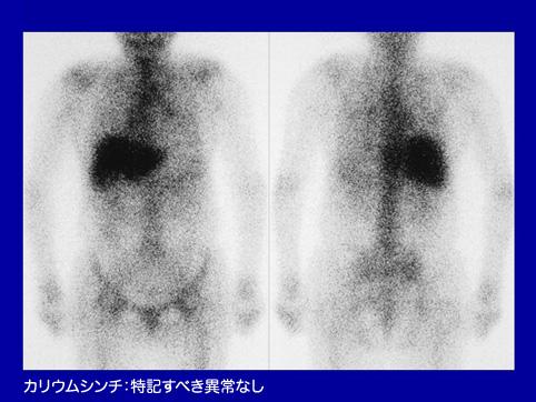 画像ID:11499