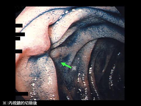 画像ID:11515