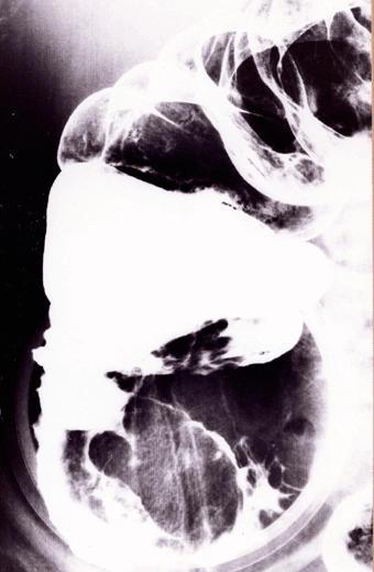 画像ID:818