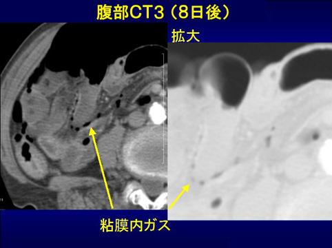 画像ID:11620