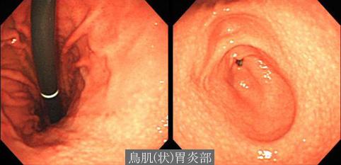 画像ID:11650