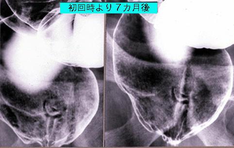 画像ID:1009
