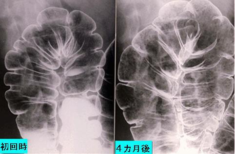 画像ID:981
