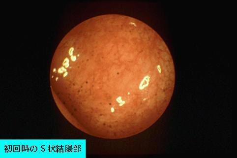 画像ID:983