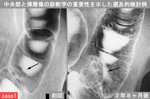 画像ID:12110