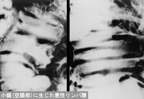 画像ID:12198
