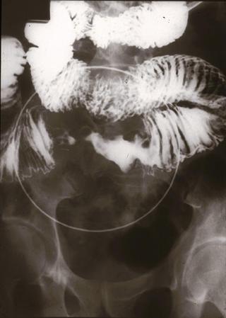 画像ID:1464